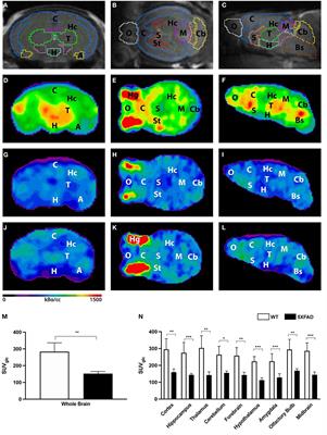 Quantitative Brain Positron Emission Tomography in Female 5XFAD Alzheimer Mice: Pathological Features and Sex-Specific Alterations